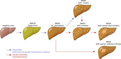 Development of a reference and proficiency chemical list for human steatosis endpoints in vitro